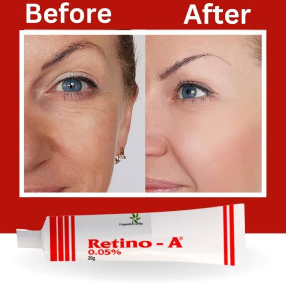 Tretinoin Retino-A 0.05% Cream, 20g tube