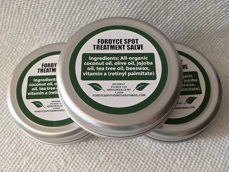 Fordyce Spots Tretinoin treatment cream.