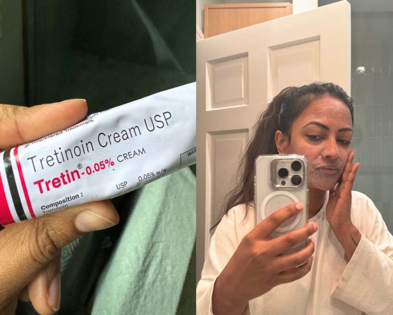 Tretinoin 0.01% gel before & after results. See visible skin improvement.