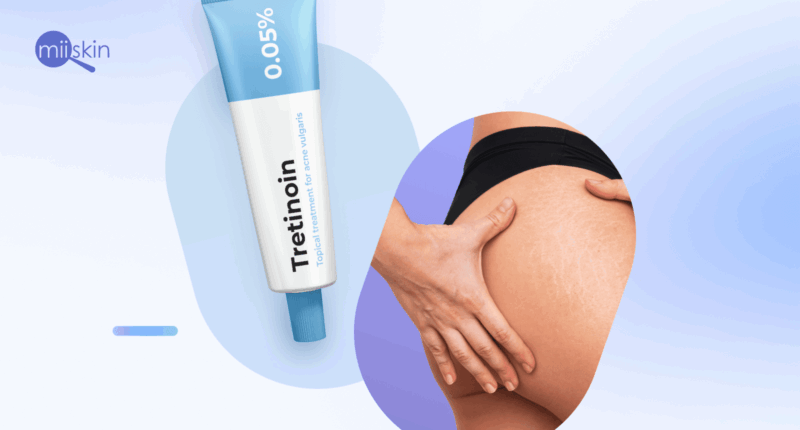 Hyaluronic acid & tretinoin stretch mark cream.