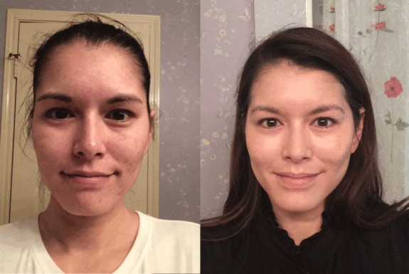 Tretinoin cream for anti-aging.