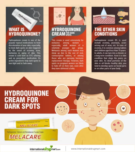 Hydroquinone cream for eczema treatment.