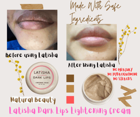 Hydroquinone lip cream.