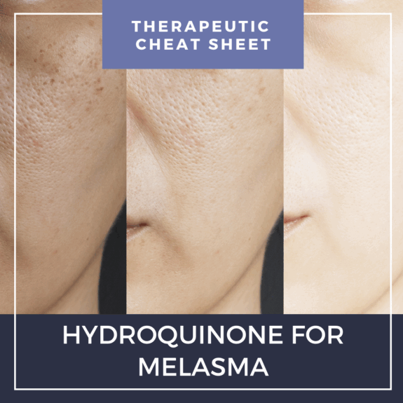 Hydroquinone tretinoin cream, skin lightening treatment.