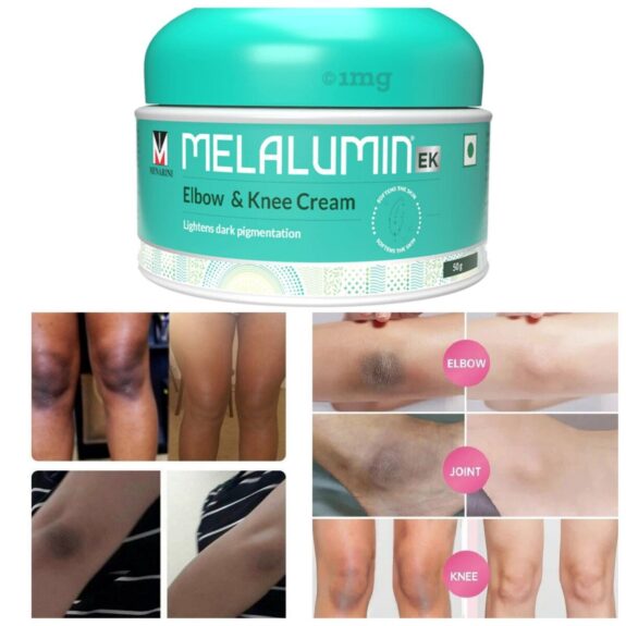Hydroquinone Cream 1mg: Product image